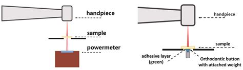  Yttriumaluminiumgarnet - Die Zukunft der Lasertechnologie?